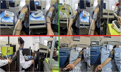The impact of sphygmomanometer placement and cuff placement on blood pressure measurements